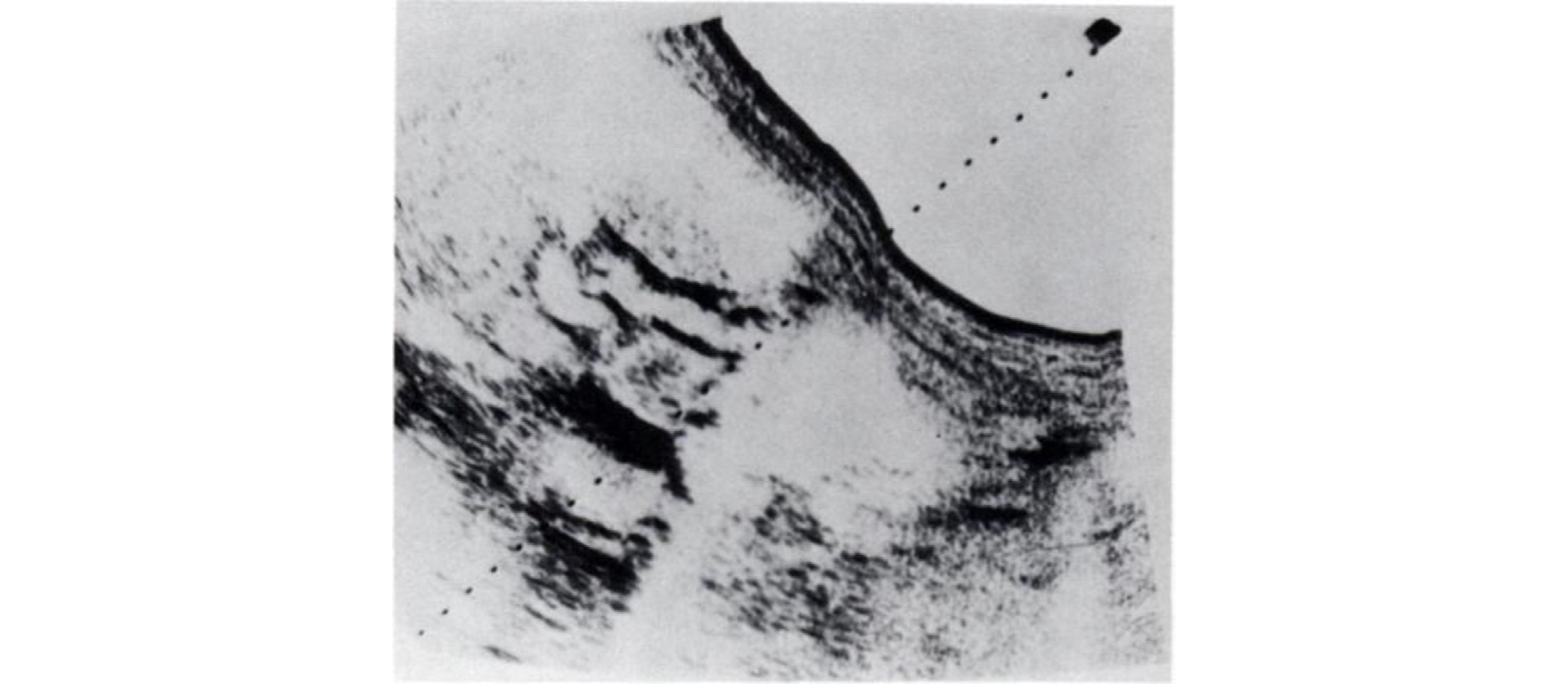 Sonogram
