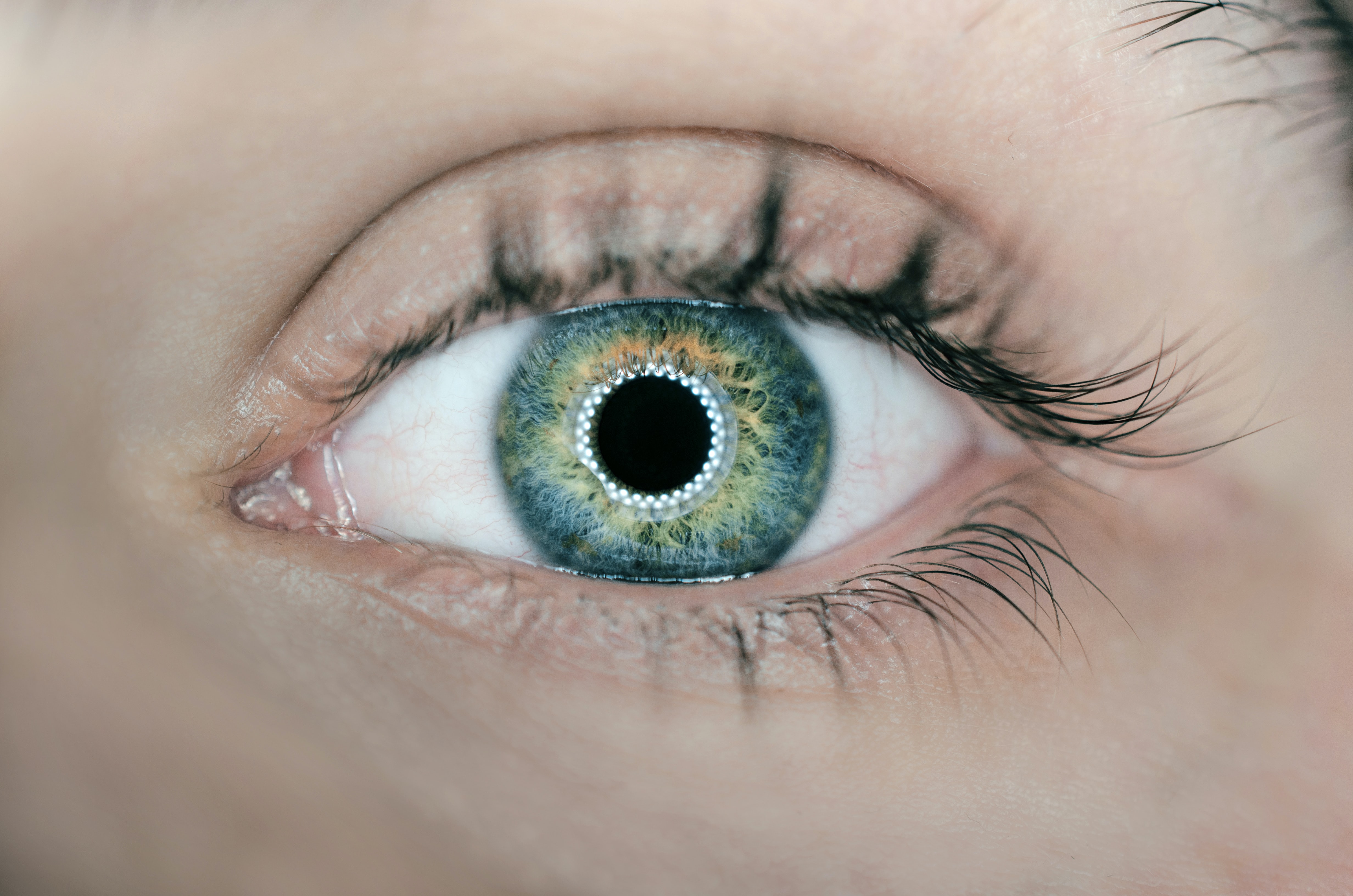 Eye